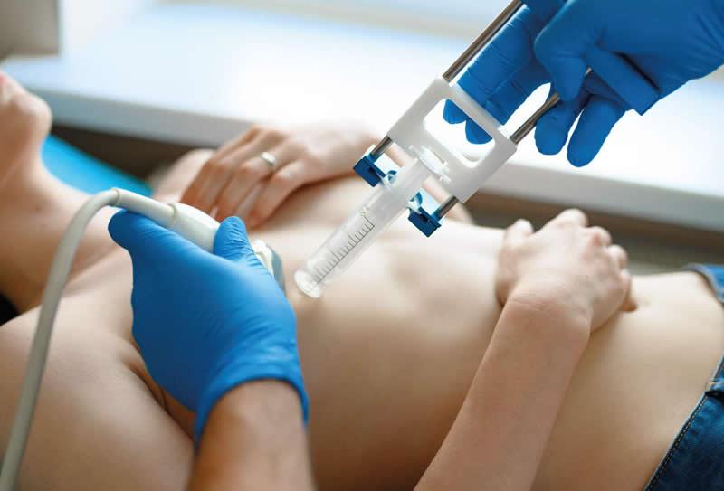 Quando a biópsia é realmente necessária?