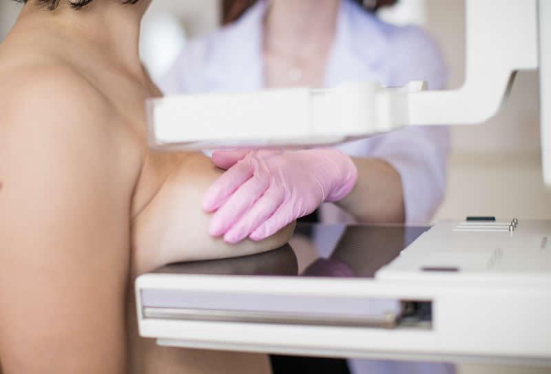 Mamografia: conheça alguns mitos sobre o exame