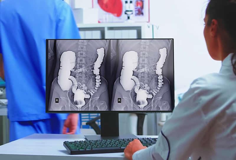 Exames contrastados: Cuidados após o exame